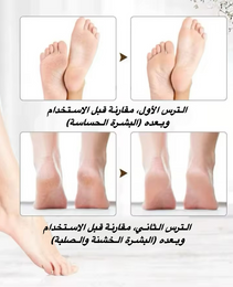 مقشر اقدام كهربائي