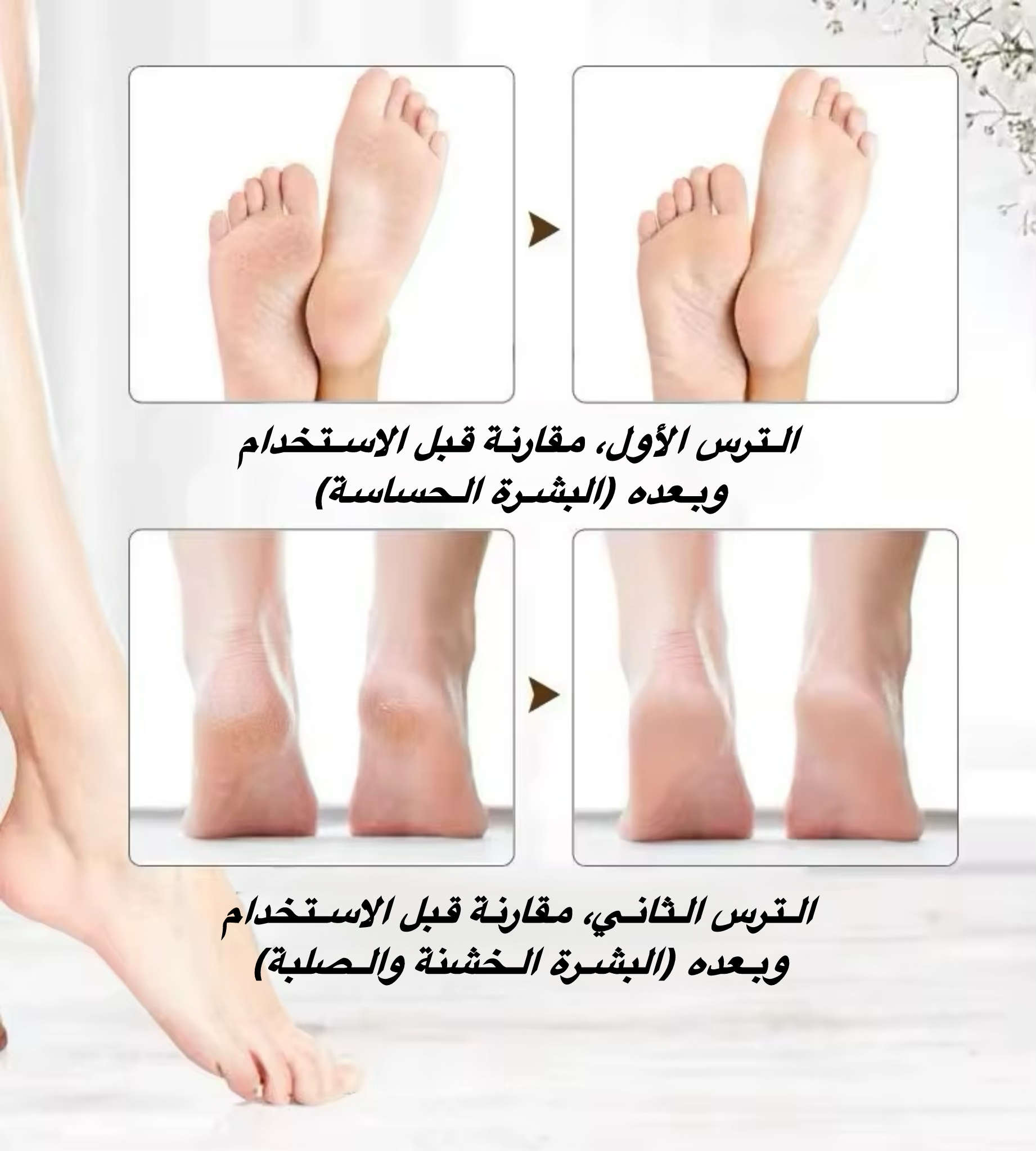 مقشر اقدام كهربائي